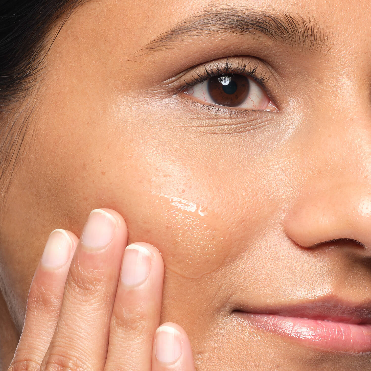 ALOE 2% + NAG SOLUTION  (SUERO PARA TRATAMIENTOS POST ACNÉ CON ALOE)